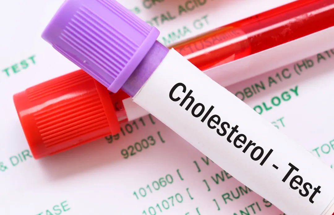 Nieprawidłowy cholesterol w insulinooporności