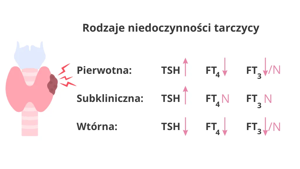 Hashimoto w insulinooporności